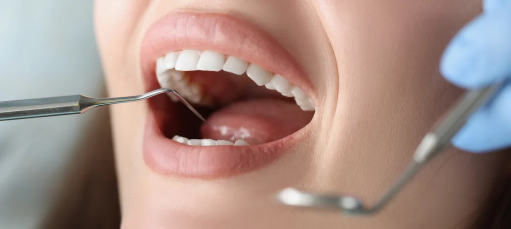 Esthétique dentaire Toulouse