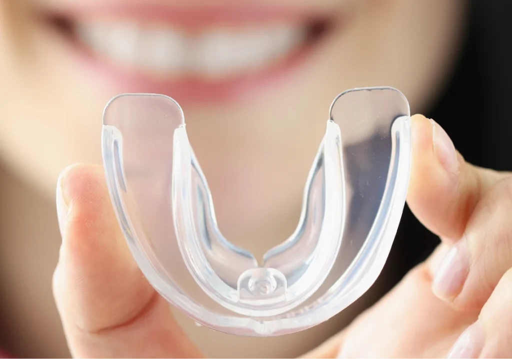 Gouttière occlusale transparente sur mesure protection bruxisme – Cabinet le 42 Toulouse