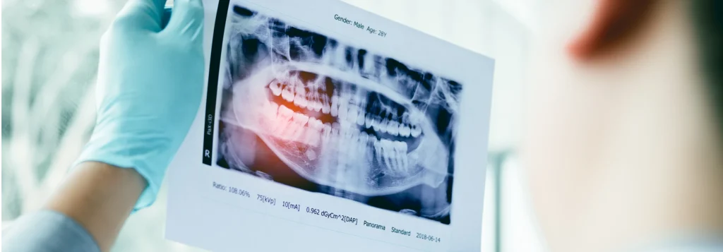 Dentiste analysant une radiographie panoramique dentaire – Cabinet le 42 Toulouse
